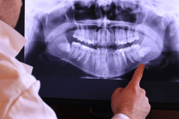 Best Urgent Tooth Repair  in Cypress, CA