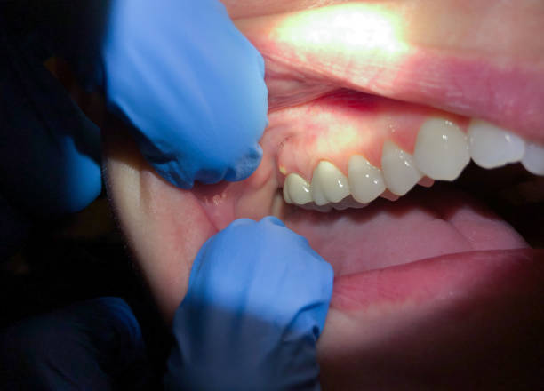 Best Emergency Gum Pain Relief  in Cypress, CA