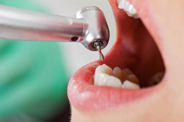 Best Root Canal Emergency Dentist  in Cypress, CA